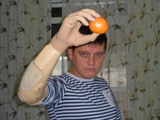 Боец, лишившийся в АТО обеих рук, благодаря специальным протезам снова... водит автомобиль