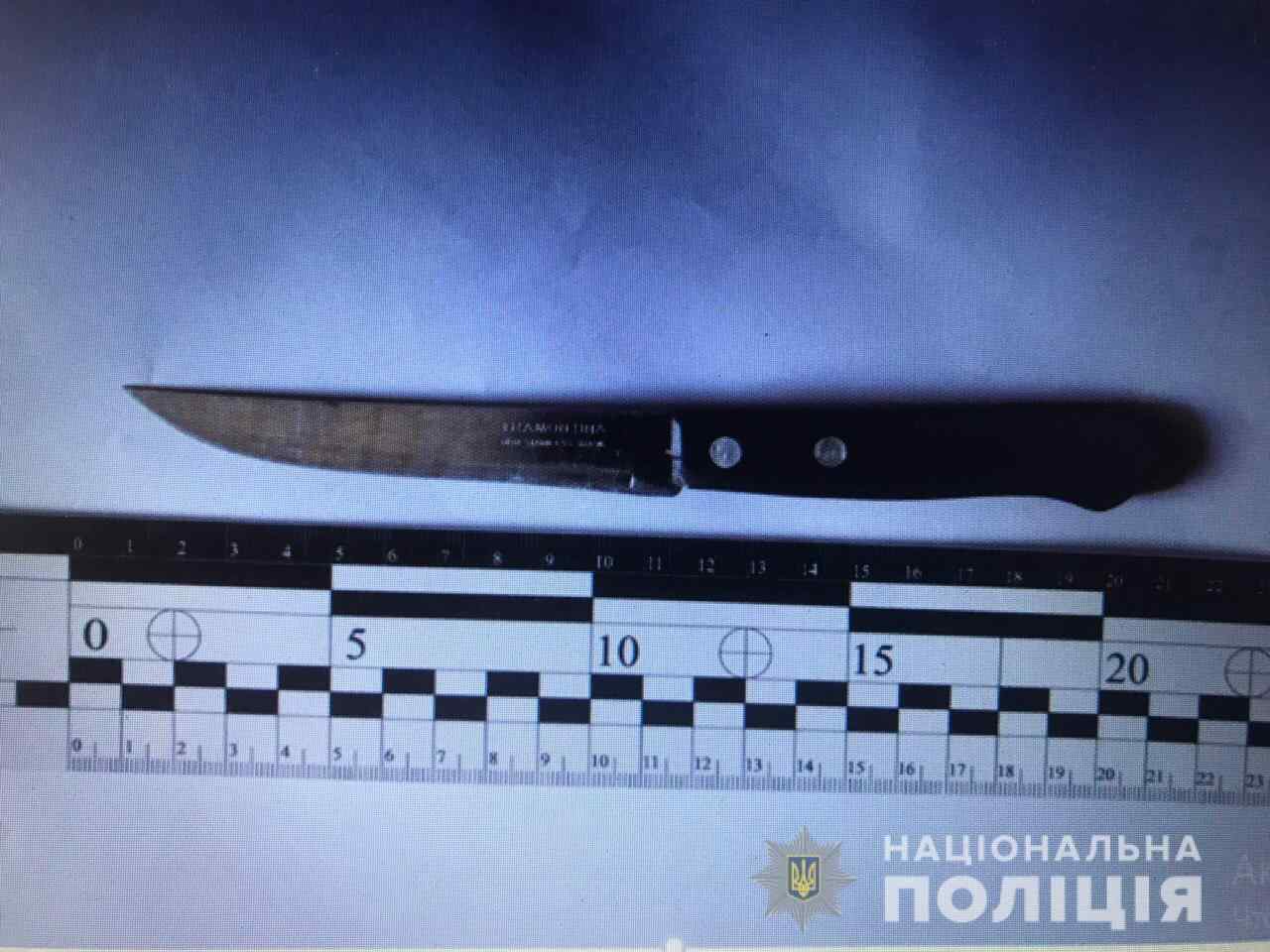 «Милые бранятся»: одесситка во время ссоры ударила своего мужа ножом в шею