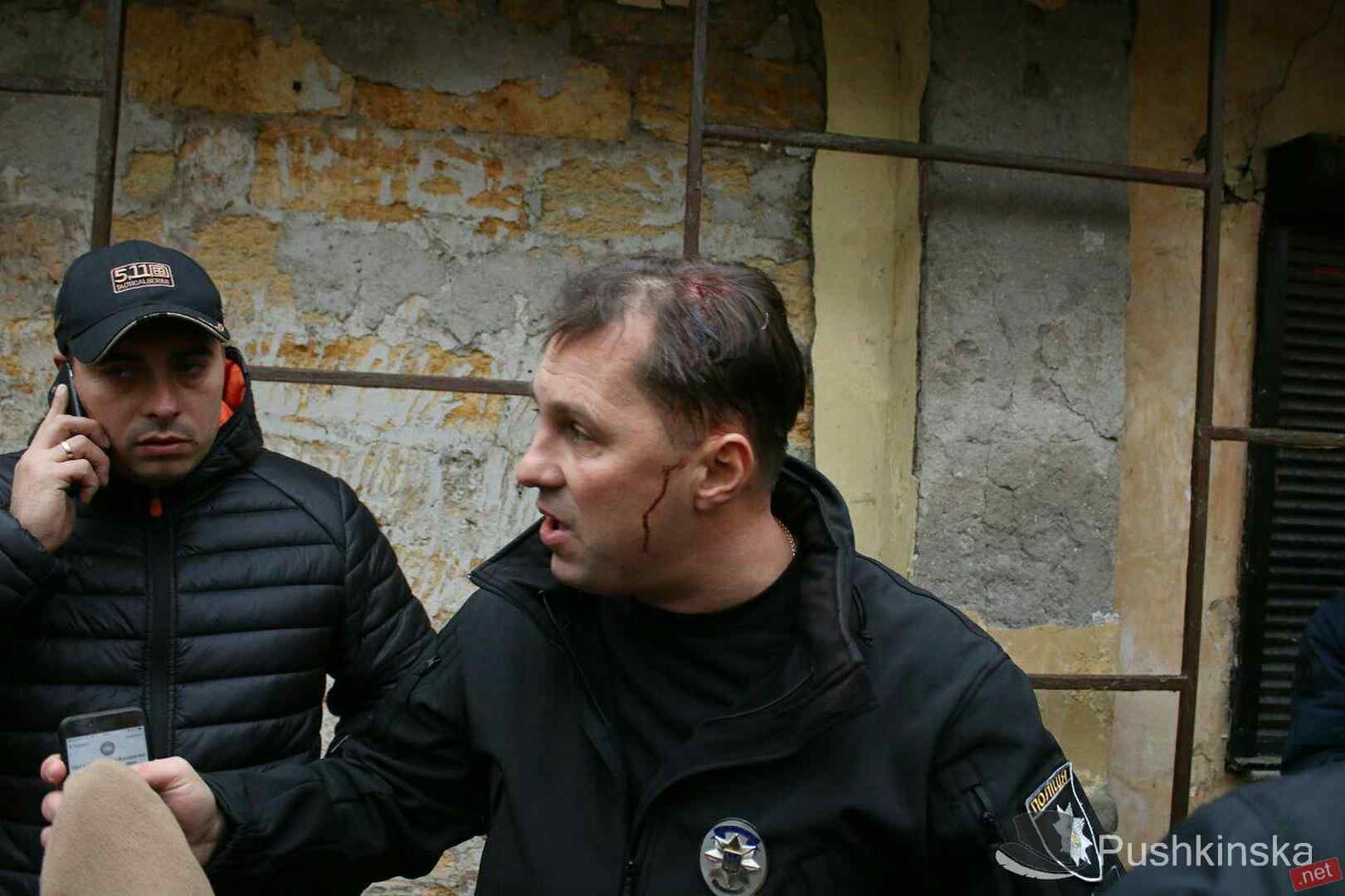 Начальник полиции Одесской области ранен во время потасовки в Горсаду. Фото, видео, обновлено