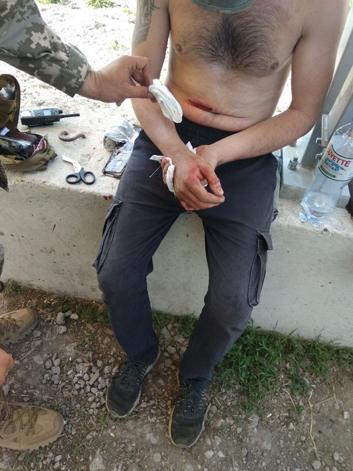 Бежал от боевиков: пограничники рассказали о спасении раненого жителя неподконтрольного Шахтерска