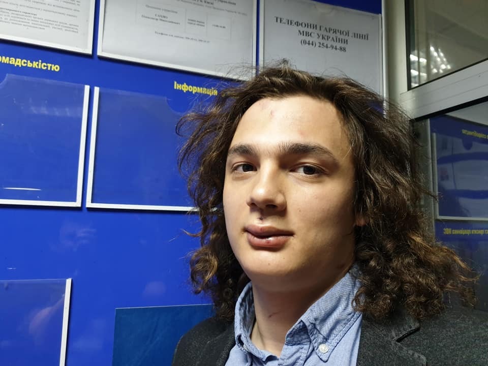 В Киеве банды подростков систематически избивают людей: стало известно о новых случаях (фото, видео)