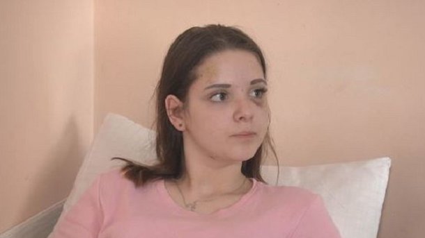 Жорстоке побиття школярки у Чернігові: чому досі ніхто не покараний
