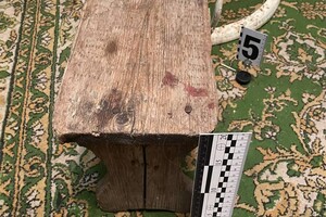 Под Одессой квартирант отправил женщину в кому из-за телевизора