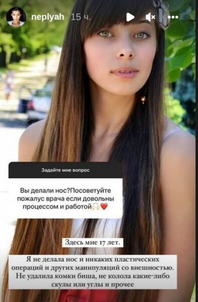 Никакой пластики: Анна Неплях показала, как выглядела в 17 лет Никакой пластики: Анна Неплях показала, как выглядела в 17 лет