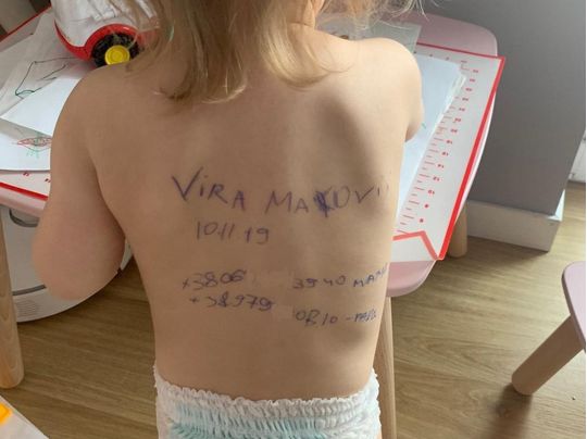 Мама написала контактну інформацію на тілі дворічної дочки: історія фото, що стало вірусним