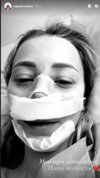Дружина Віктора Павліка зробила пластичну операцію та показала, як тепер виглядає
