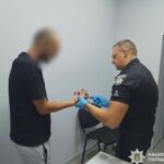 В Одесской области мужчина поджег знакомую — его уже задержали